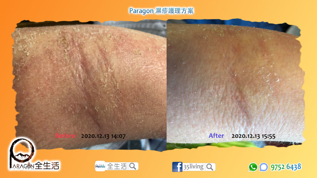 Paragon MilkySPA 全生活微泡水療機 (2025最新版) 3 35living MeWeF E01