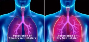 Salt Inhaler Dry